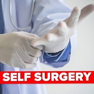 463K views · 1.7K reactions | A doctor was curious and decided to remove his own appendix In today's video of The Infographics Show we take a look at just how this surgery happened and how this doctor lived through this to tell his story! | The Infographics Show | Facebook