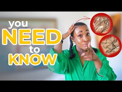 Is your scalp DRY, OILY, or NORMAL?! // Scalp Care Series