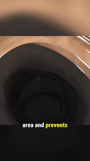 14K views · 82 reactions | Colon Polypectomy Procedure (3D Animation Explanation) #Colonoscopy #healthcare #healthytips | Natural Recipes369 | Facebook