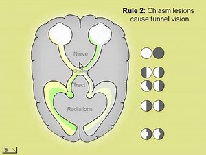 Neuro-Ophthalmology Lecture 2