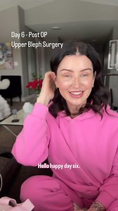 29K views · 80 reactions | Day 6 - March 12, 2025 Upper Bleph...