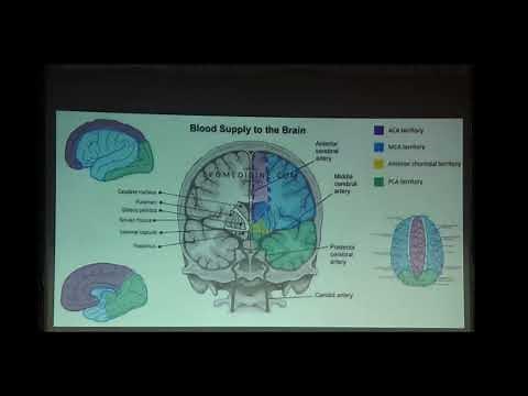 CME Series Video 2 || Approach to Acute Stroke in ER