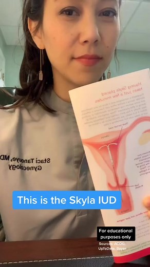 Skyla vs. Kyleena: Comparing Side Effects and Risks