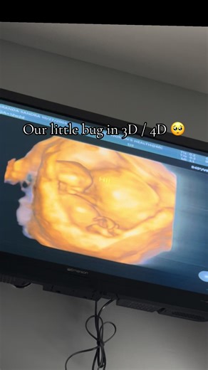 12 Week Ultrasound Journey: Our Baby's First Moments