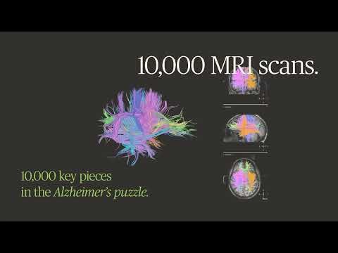 BBRC | 10,000 MRI scans advancing Alzheimer's research