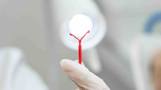 Quand et comment poser un stérilet pour une contraception efficace ?
