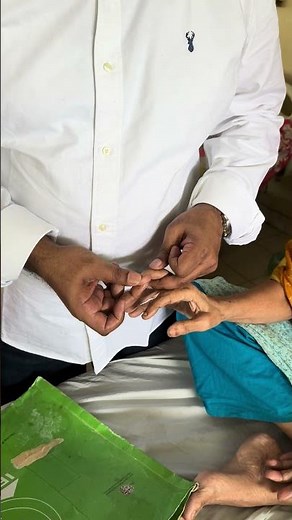 Hoffman sign ( indicates upper motor neuron disease) #hoffman #UMNL