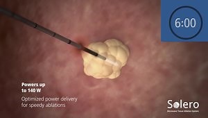 Solero Microwave Tissue Ablation System Animation