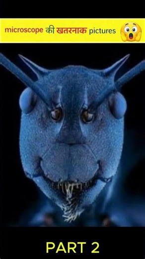 Dangerous Things Under Microscope 🤯 #facts #shorts