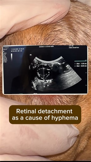 Dr Svetlana Formenova. DVM. Veterinary ophthalmologist on Instagram: "Hyphema is the presence of blood in the anterior chamber. There are many possible causes — but we must remember: hyphema is a symptom, not a diagnosis. That’s why our job is to look for the underlying cause. Step one? Complete ophthalmic examination. To do that, we need to assess the fundus. But here’s the challenge: in many cases of hyphema, direct visualization of the retina is impossible. So what’s next? Ocular ultrasound. 