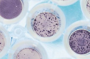 Immunisation—protecting our children from disease