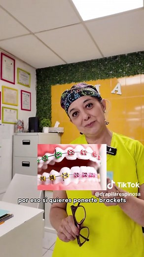 Duración del tratamiento de brackets y su impacto