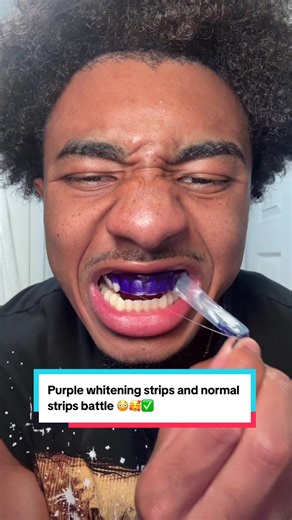 Testing Dr. Dent's Purple Whitening Strips: Results Revealed!