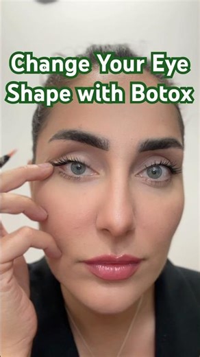 #AdvancedBotox: Open Up Tired Eyes Without Surgery