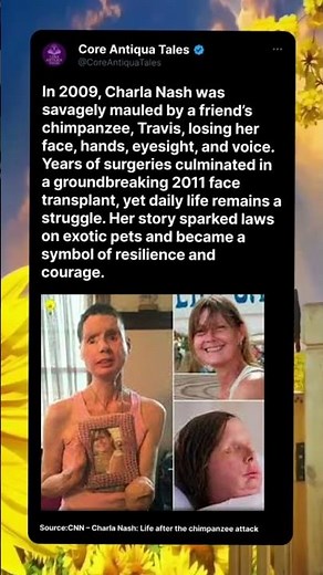 The Woman Attacked by a Pet Chimpanzee and Rebuilt Her Life Through a Face Transplant — Charla Nash