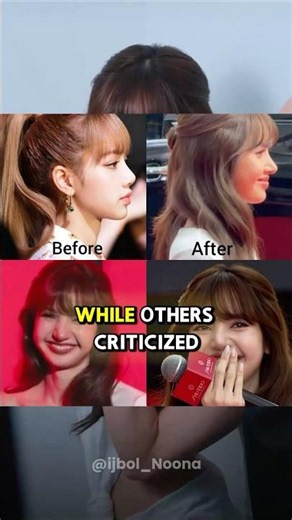 BLACKPINK Lisa's Nose Job Sparks Massive K-Pop Controversy 😳
