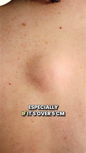 Ever noticed a new lump or swelling that just won't go away?