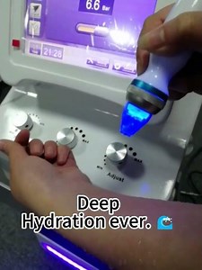 The Ultimate Deep Cleansing Machine: Oxygen Jet Peel & dermabrasion Demo 💦