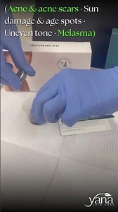 Ever wondered what a VI Peel actually looks like? ✨