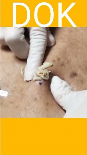 Enjoy Every Day With Loan Nguyen Spa Beauty New Video 008 #shorts