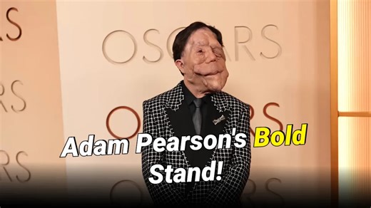 Adam Pearson Blasts Comedian’s ‘Character’ After He Makes Fun of His Appearance