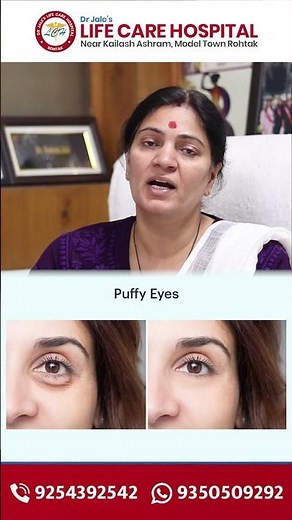 Puffy Eyes Treatment Without Surgery | HIFU Under Eye Treatment Explained