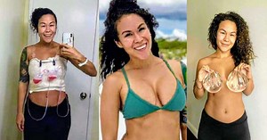 ‘I was 22 and wanted to feel feminine. My husband said breast implants would help ‘spice things up.’: Woman removes implants after plagued by Breast Implant Illness, ‘Removing them gave me the confidence I lacked for years’