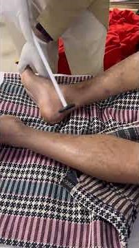 Spread of a Reflex | Ankle and Knee | Crossed Extensor Reflex | 🧠 Sign of Hyperreflexia