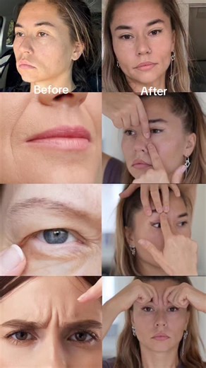 Face & Body rejuvenation on Instagram: "There was a moment when I looked in the mirror and couldn’t recognize myself. My face looked tired, puffy, uneven… and honestly, it made me really sad. For a long time I thought it was just “aging.” But it wasn’t. It was tension, posture, my neck, my scalp, the way my skull was sitting — all the deep structural patterns nobody talks about. After pregnancy it got even worse. My mid-face started sinking, everything shifted, and I felt like I lost the face I 