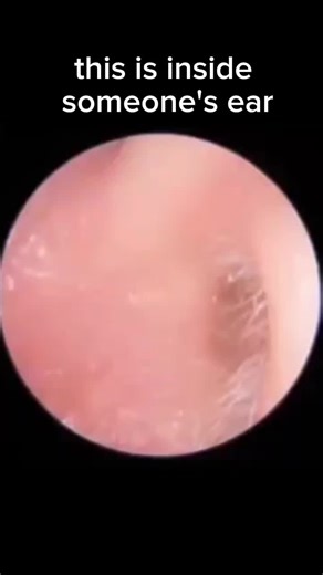 How to Properly Clean Your Ears Safely