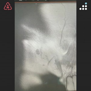 Orthobullets on Reels