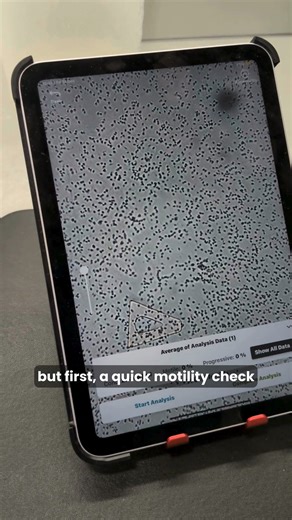 Project Coral 2025 part 2 - The freezing! After collecting the coral and sea urchin semen, it is time to freeze! Firstly, we added cryoprotectant solutions to each sample to protect the sperm cells during the freezing process. We then used our portable freezing devices (designed by Mary Hagedorn's research group at the Smithsonian Conservation Biology Institute and 3D printed by Rob Lickley) to freeze the samples at a controlled rate until they reached -80⁰C. After this, they were submerged into