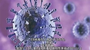 EB病毒抗体检测试剂盒（酶联免疫法 ）