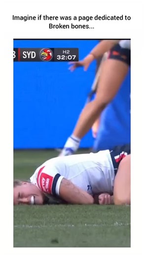 Posting Broken Bones | If only there was a page dediacted to broken bones... Looking to grow? Follow @brown_derrek and get featured - no strings attached.... | Instagram