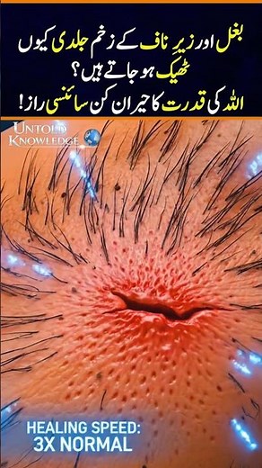 The Hidden Science of Faster Healing in Certain Body Areas