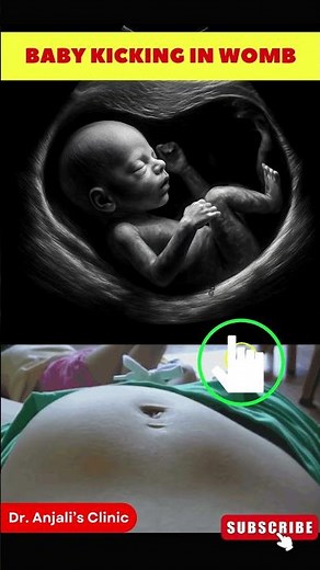Baby Kicking in Womb | Fetal Movement