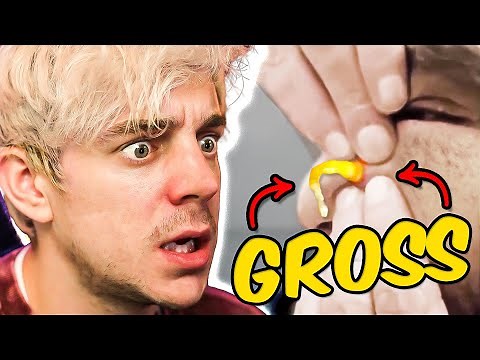 Reacting to the Grossest Pimple Popping Videos