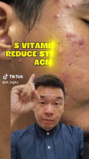 5 Vitamins to Fight Stubborn Acne