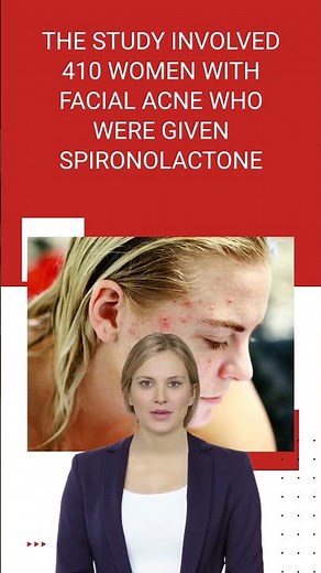 Spironolactone: A Promising Acne Solution for Women's Skin