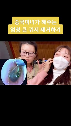 중국미녀가 해주는 엄청 큰 귀지 제거하기 #귀청소#귀파기#미녀#采耳#earcleaning