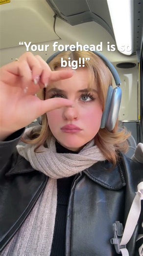 are you sure??? #viral #music #relatable #forehead