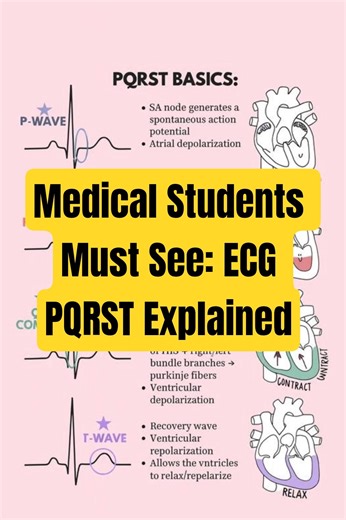 Medical Students Must See: ECG PQRST Explained #youtubeshorts #trendingshorts #drxhealthexpress