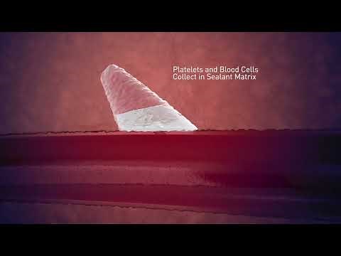 Step by Step guide to use MYNX CONTROL™ VCD