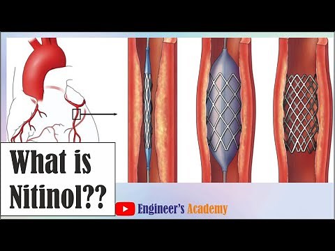 What is Nitinol??