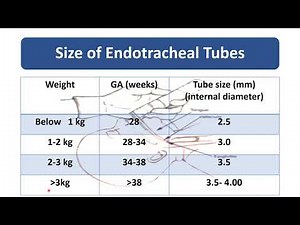 Endotracheal Intubation | Pediatrics