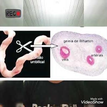 Conhece a geleia de Wharton?