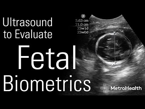 Ultrasound to Evaluate Fetal Biometrics