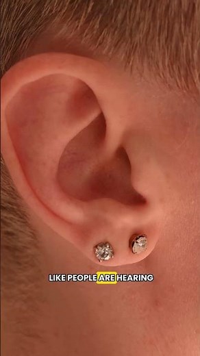 Living Through Psychosis | My Disney & Pixar Delusion #GaboDeRose #shorts