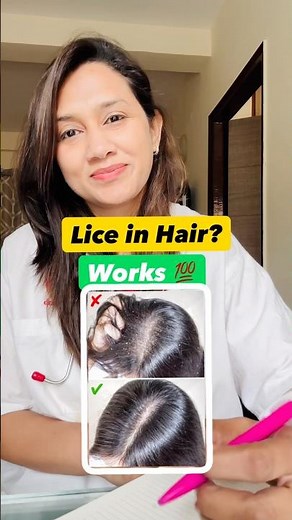 Head Lice Treatment at Home | How to Remove Lice & Nits Fast | Permethrin Solution + Iveria Shampoo