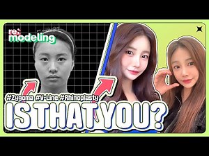 Facial Contouring Surgery Korea Before and After Nose Job in Korea